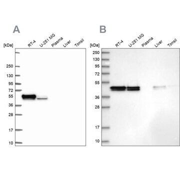 Anti-RCN1 antibody produced in rabbit Prestige Antibodies&#174; Powered by Atlas Antibodies, affinity isolated antibody, buffered aqueous glycerol solution