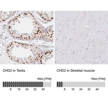 抗CHD2抗体 ウサギ宿主抗体 Prestige Antibodies&#174; Powered by Atlas Antibodies, affinity isolated antibody, buffered aqueous glycerol solution