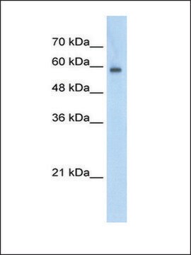 抗EIF4G3抗体 ウサギ宿主抗体 affinity isolated antibody