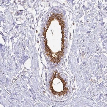 Anti-CIB1 antibody produced in rabbit Prestige Antibodies&#174; Powered by Atlas Antibodies, affinity isolated antibody