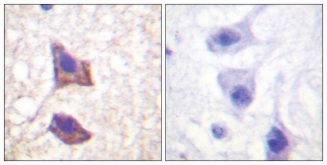 Anti-CD130 antibody produced in rabbit affinity isolated antibody