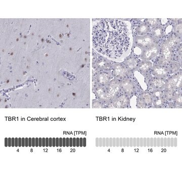 Anti-TBR1 Prestige Antibodies&#174; Powered by Atlas Antibodies