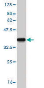 Monoclonal Anti-CYP24A1 antibody produced in mouse clone 1F8, purified immunoglobulin, buffered aqueous solution