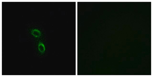 Anti-ARMC6 antibody produced in rabbit affinity isolated antibody