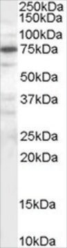 抗PPP1R15A/GADD34抗体 ヤギ宿主抗体 affinity isolated antibody, buffered aqueous solution