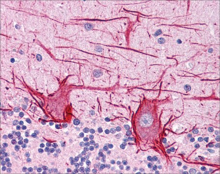 Anti-APOB antibody produced in rabbit affinity isolated antibody