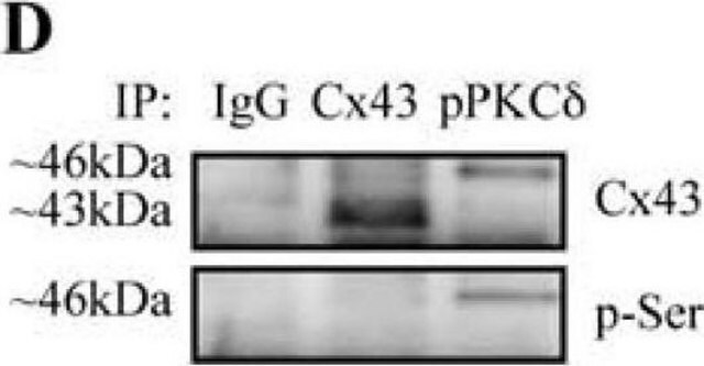 Monoclonal Anti-Phosphoserine antibody produced in mouse clone PSR-45, purified from hybridoma cell culture, buffered aqueous solution