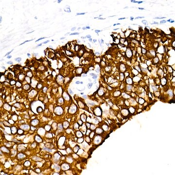 Przeciwciało przeciw cytokeratynie 19 (KRT19), klon 2Q5A5, królicze monoklonalne