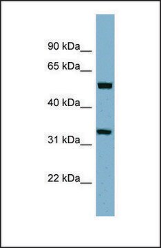 Anti-TMEM158 antibody produced in rabbit affinity isolated antibody