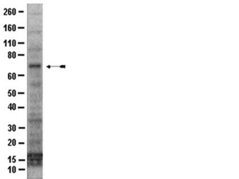 Anti-IRAK1 Antibody, CT from rabbit