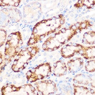 Anti-ANGPTL3 antibody produced in rabbit