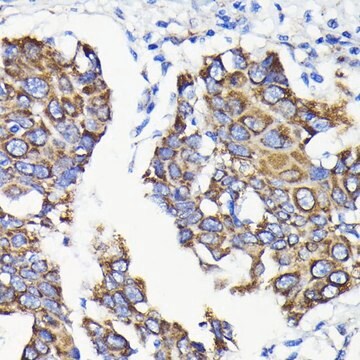 Anti- TTC11/FIS1 antibody produced in rabbit