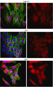 Anti-Thymosin beta-4 Antibody from rabbit, purified by affinity chromatography