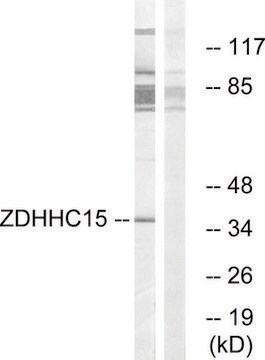 Anti-ZDHHC15 antibody produced in rabbit affinity isolated antibody