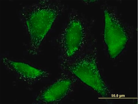 Anti-ACAA1 antibody produced in mouse purified immunoglobulin, buffered aqueous solution