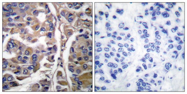 Anti-Keratin 20 antibody produced in rabbit affinity isolated antibody