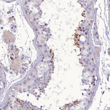 Anti-FAM149B1 antibody produced in rabbit Prestige Antibodies&#174; Powered by Atlas Antibodies, affinity isolated antibody, buffered aqueous glycerol solution