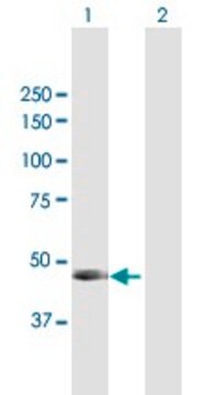 Anti-PNLIP antibody produced in mouse purified immunoglobulin, buffered aqueous solution