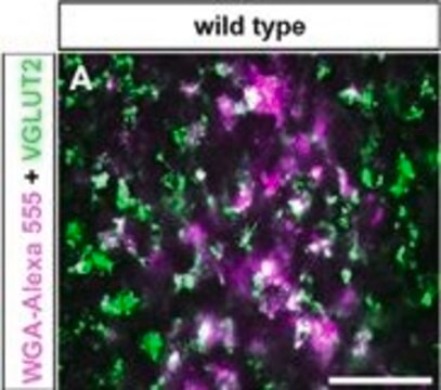 Anticorpo antitransportador vesicular de glutamato 2 clone 8G9.2, Chemicon&#174;, from mouse