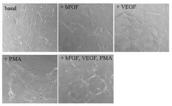 フィブリンIn Vitro血管新生アッセイ The Fibrin Gel In Vitro Angiogenesis Assay Kit represents a simple model of angiogenesis in which the induction or inhibition of tube formation by exogenous signals can be easily monitored.