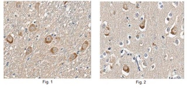 Anti-Limk1 Antibody, clone 6C3.1| MABN118 clone 6C3.1, from mouse