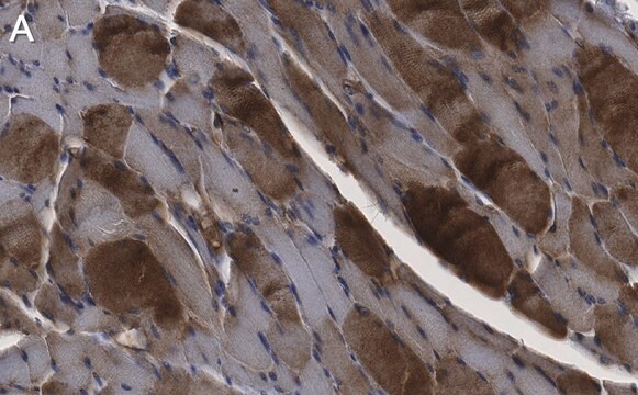 Anti-LEAP2 Antibody, clone 1D17 ZooMAb&#174; Rabbit Monoclonal recombinant, expressed in HEK 293 cells