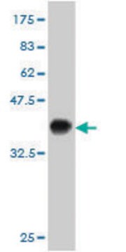 ANTI-KIT antibody produced in mouse clone 5A11, purified immunoglobulin, buffered aqueous solution