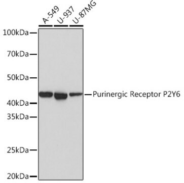 Anti-Purinergic Receptor P2Y6 Antibody, clone 4I8C9, Rabbit Monoclonal