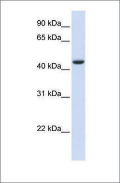 Anti-TRDMT1 antibody produced in rabbit affinity isolated antibody