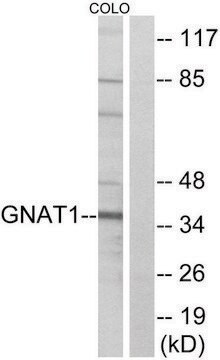 Anti-GNAT1 antibody produced in rabbit affinity isolated antibody