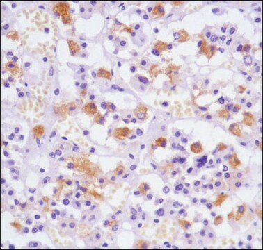 Anti-Luteinizing Hormone antibody, Rabbit monoclonal clone SP132, recombinant, expressed in proprietary host, affinity isolated antibody