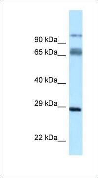 Anti-PRRT1 antibody produced in rabbit affinity isolated antibody