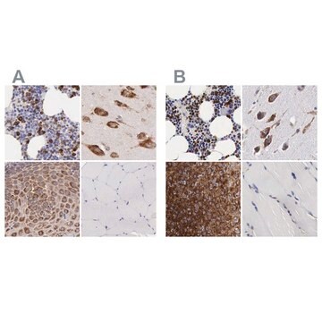 抗CKAP4 ウサギ宿主抗体 Ab2, Prestige Antibodies&#174; Powered by Atlas Antibodies, affinity isolated antibody, buffered aqueous glycerol solution