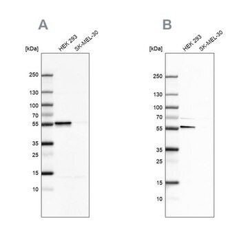 抗FKBP5抗体 ウサギ宿主抗体 Prestige Antibodies&#174; Powered by Atlas Antibodies, affinity isolated antibody, buffered aqueous glycerol solution, ab2