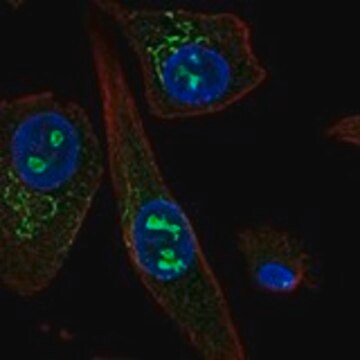 Anti-SOSTDC1 antibody produced in rabbit Prestige Antibodies&#174; Powered by Atlas Antibodies, affinity isolated antibody, buffered aqueous glycerol solution