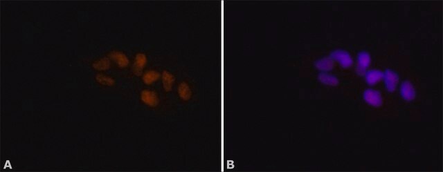 Anti-ADAR1 antibody produced in rabbit ~1.0&#160;mg/mL, affinity isolated antibody