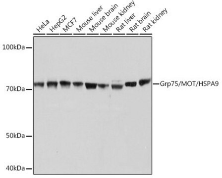 Anti-Grp75/MOT/HSPA9 antibody produced in rabbit