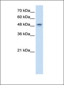 Anti-DHODH (AB1) antibody produced in rabbit affinity isolated antibody