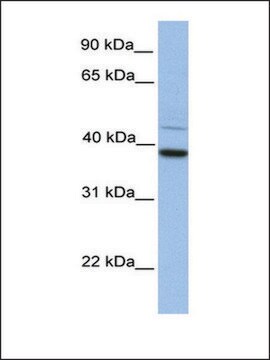 抗 FKBP8 兔抗 affinity isolated antibody