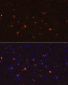 Anti-S100B antibody produced in rabbit