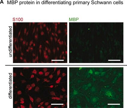 Anti-S-100-Protein-Antikörper, Klon 15E2E2 clone 15E2E2, Chemicon&#174;, from mouse