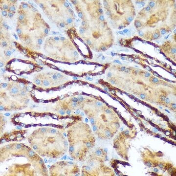 Anti-Versican antibody produced in rabbit