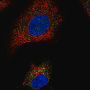 Anti-Sdhaf1 Antibody Produced In Rabbit Prestige Antibodies&#174; Powered by Atlas Antibodies, affinity isolated antibody, buffered aqueous glycerol solution