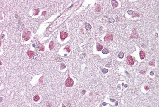 Anti-ETV1 antibody produced in rabbit affinity isolated antibody