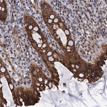 Anti-ABLIM1 antibody produced in rabbit Prestige Antibodies&#174; Powered by Atlas Antibodies, affinity isolated antibody, buffered aqueous glycerol solution