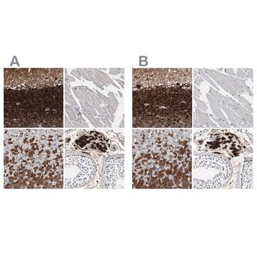 Anti-CALB2 antibody produced in rabbit Prestige Antibodies&#174; Powered by Atlas Antibodies, affinity isolated antibody, buffered aqueous glycerol solution