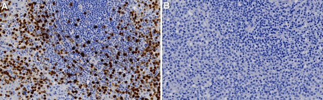 Anti-Perforin-1 Antibody, clone 1H11 ZooMAb&#174; Rabbit Monoclonal recombinant, expressed in HEK 293 cells