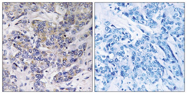 Anti-RPS21 antibody produced in rabbit affinity isolated antibody