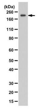 Anti-ZEB1 Antibody from rabbit, purified by affinity chromatography