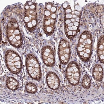 Anti-TAB1 antibody produced in rabbit Prestige Antibodies&#174; Powered by Atlas Antibodies, affinity isolated antibody, buffered aqueous glycerol solution